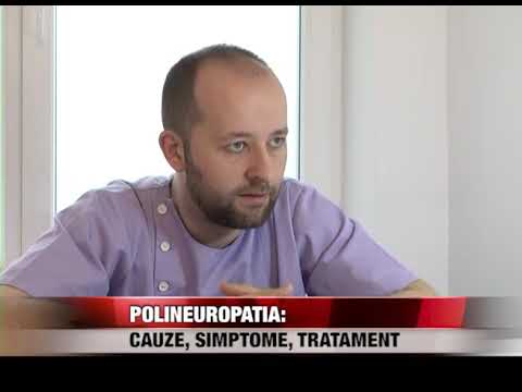 Poliartrita reumatoidă unde se tratează recenziile