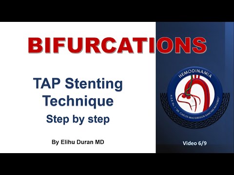 TAP Stent