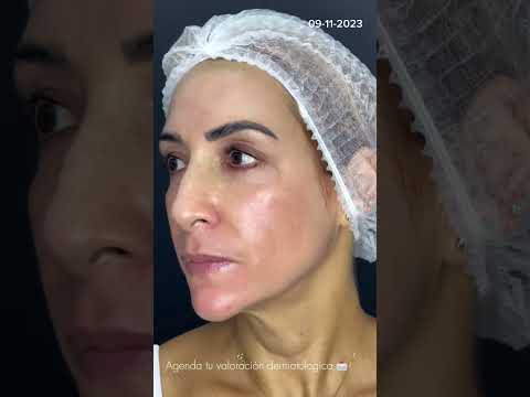 video JbykVWncJNI
