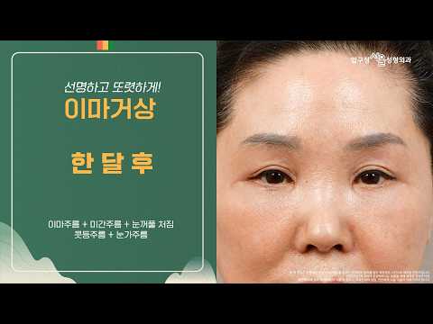 #�̸��Ż� �Ѵ��� ������ �ÿ��ϰ� �Ƿ��ϰ�!