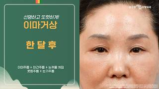 #이마거상 한달차