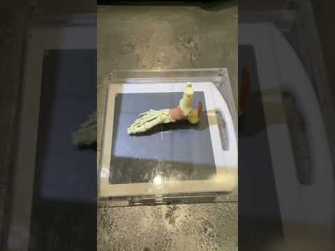 The quickest X-Ray