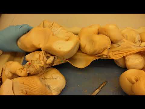 Pig urinary and reproductive systems dissection.