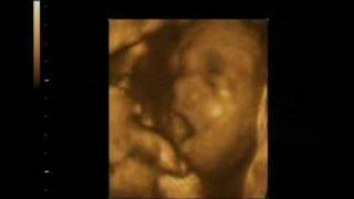 Bostezo de un feto - Samaranch Consulta Ginecológica