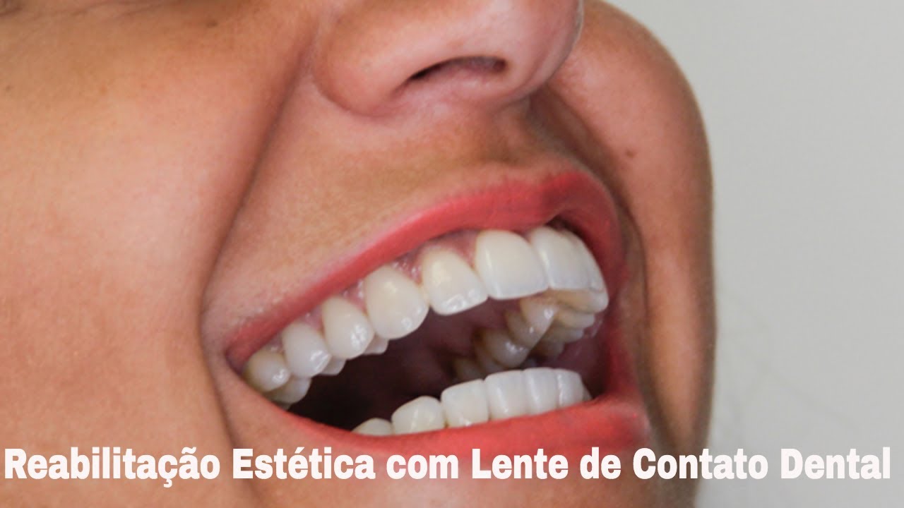 Saint Clair Barbosa Netto-34