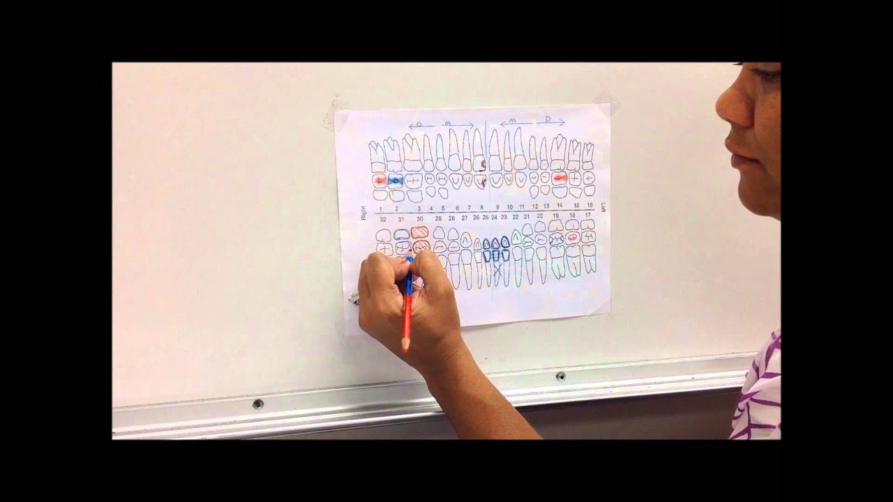 Instructional Charting Video