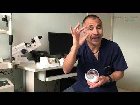 ¿En qué consiste la cirugía de la presbicia?