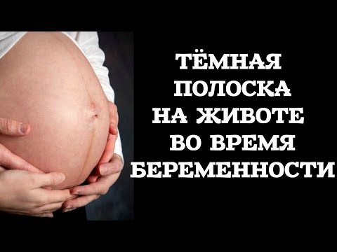 Высокая пигментация кожи Касторовое масло помогает от веснушек