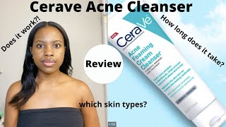 Watch This Before You Buy: Cerave Acne Foaming Cream Cleanse