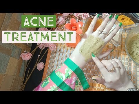 Easiest Way To Remove Acne "Scars and Spots" (Homemade Acne Treatment) Video