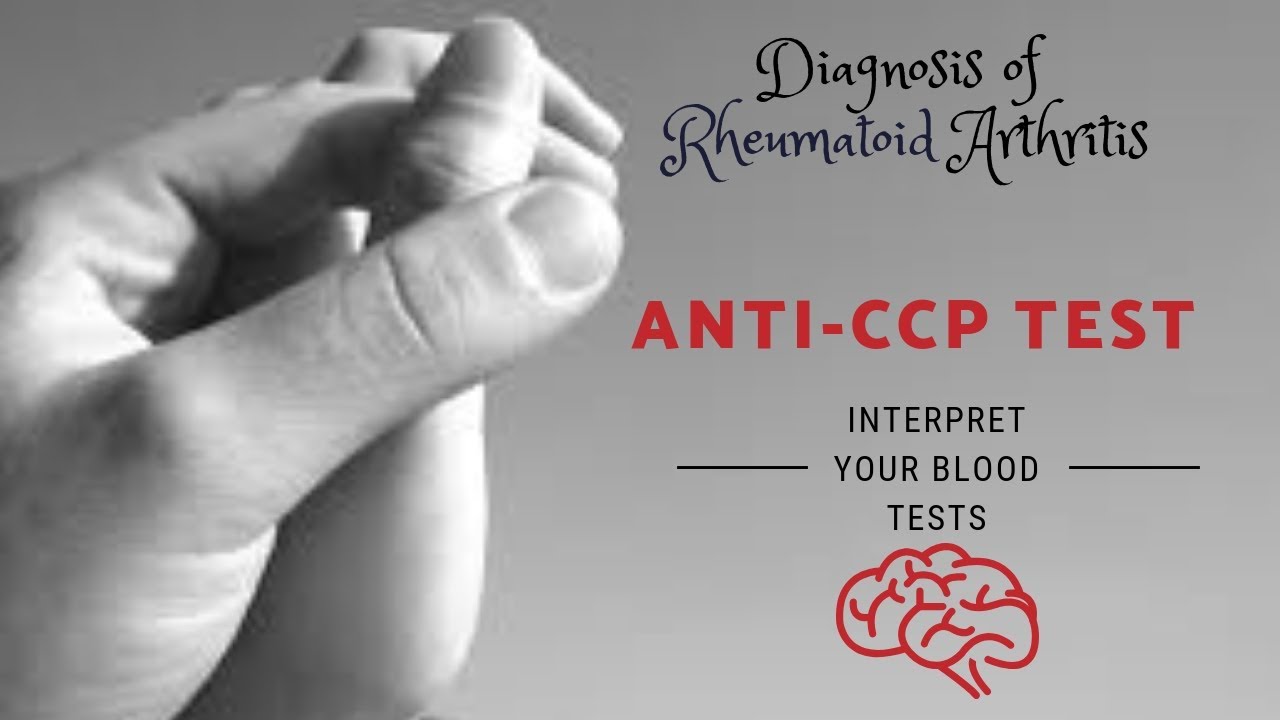 What is CCP normal range? More REF