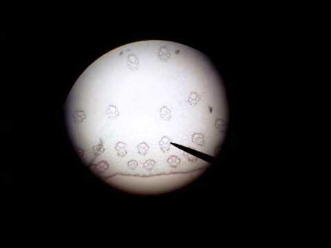 Microscopic Monocot Corn Stem Cross Section Anatomy Part 2