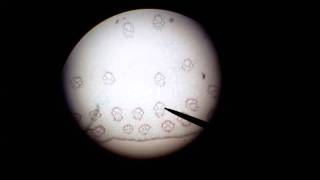 microscopic monocot corn stem cross section anatomy, Part 2