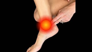 Relief For Ankle Arthritis! Top 5 Exercises