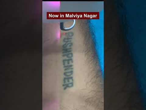 Laser Tattoo Removal | Viral #shorts