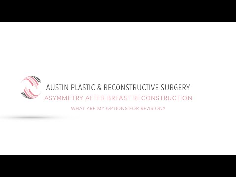 ASYMMETRY AFTER BREAST RECONSTRUCTION: What Are My Options for Revision?