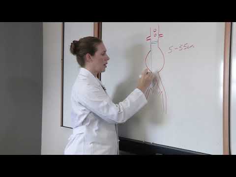 Claire Griffin, MD  Abdominal Aortic Aneurysm Disease