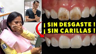6 pacientes reaccionan al verse por primera vez sin manchas dentales. !SIN DESGASTE, SIN CARILLAS!