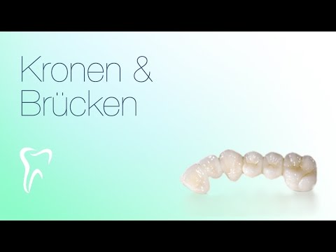 Zahnkrone Leverkusen Brücke Zahnersatz Zahnsanierung VollProthektik