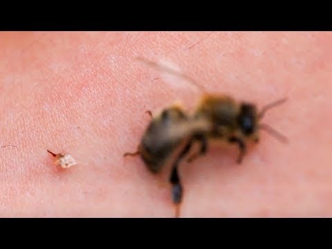 Heilkraut senkt den Blutzucker Diabetes im Jahr 2006