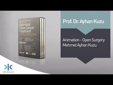 2.1.1. Animation - Open Surgery - M. Ayhan Kuzu