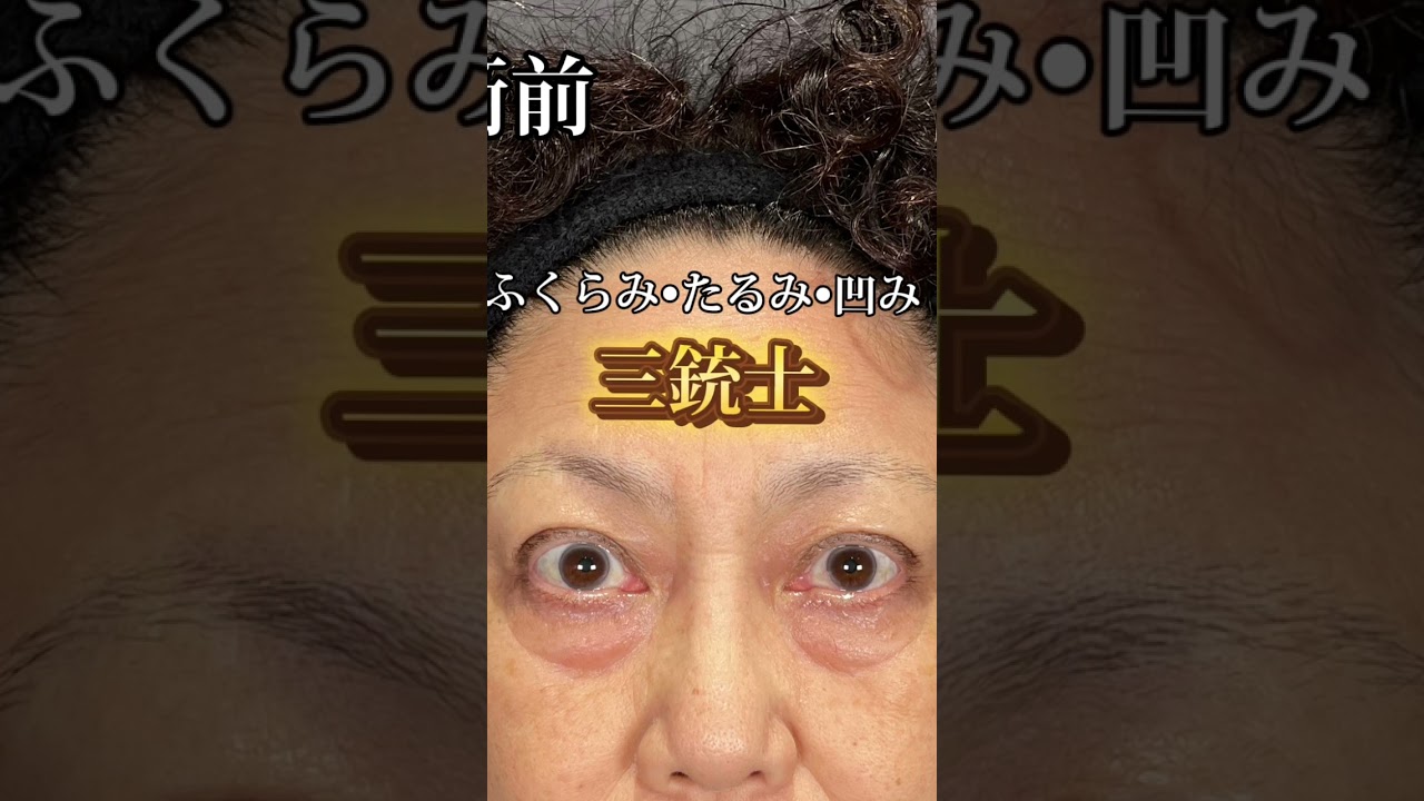 クマ取りはクマ取りマイスターのDr.今村にお任せ👍✨