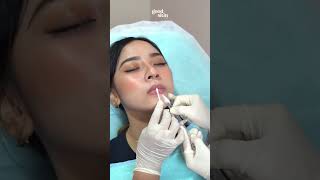 Download lagu Artis ibu kota treatment ini lho, cobain deh hasilnya waw banget! mp3 Download lagu Artis ibu kota treatment ini lho, cobain deh hasilnya waw banget! mp3