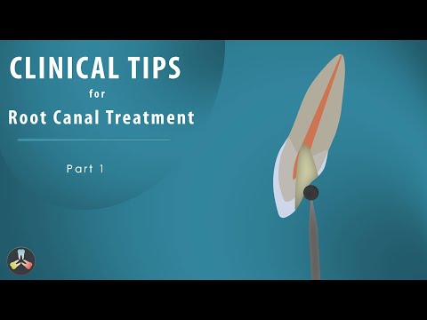 Root Canal Treatment | Clinical tips | Part 1