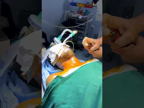 Preparando-se para cirurgia na coluna cervical 😮