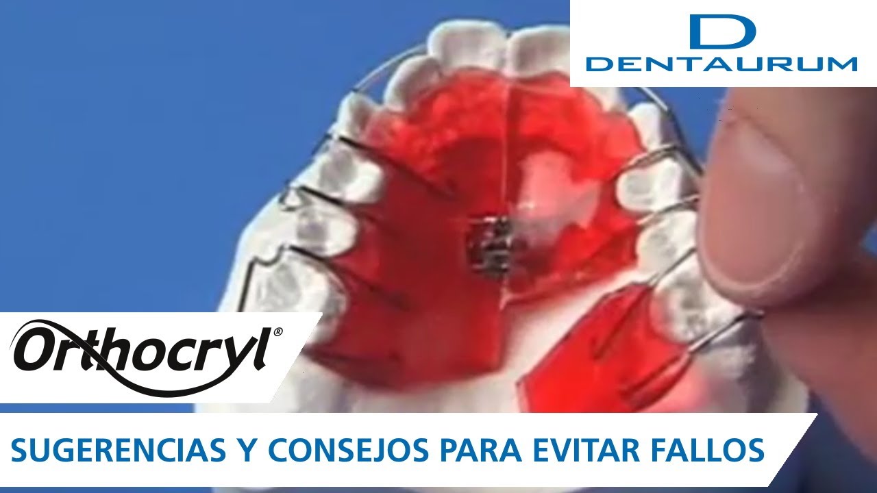 Orthocryl®  - sugerencias y consejos para evitar fallos (aparatos dentales)