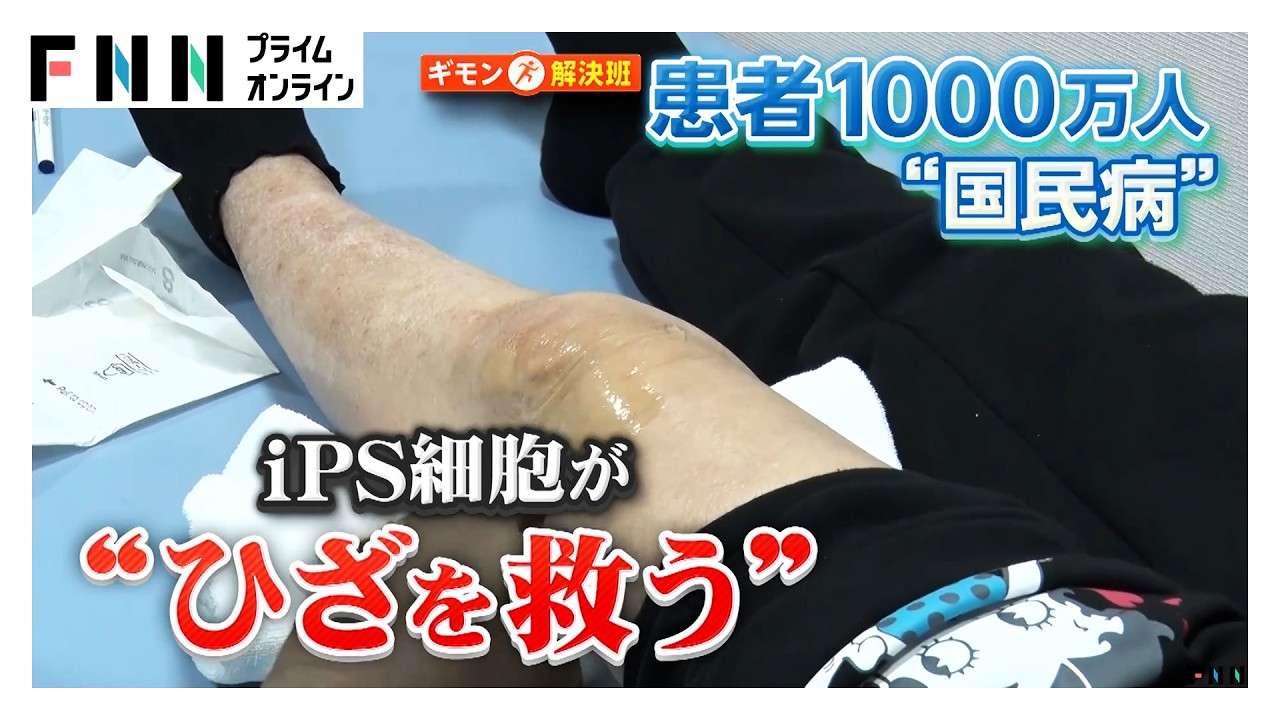 iPS細胞が1000万人の“ひざを救う”？“世界初”人工軟骨の新技術…安全面・生産コストが課題（2026年03月13日）