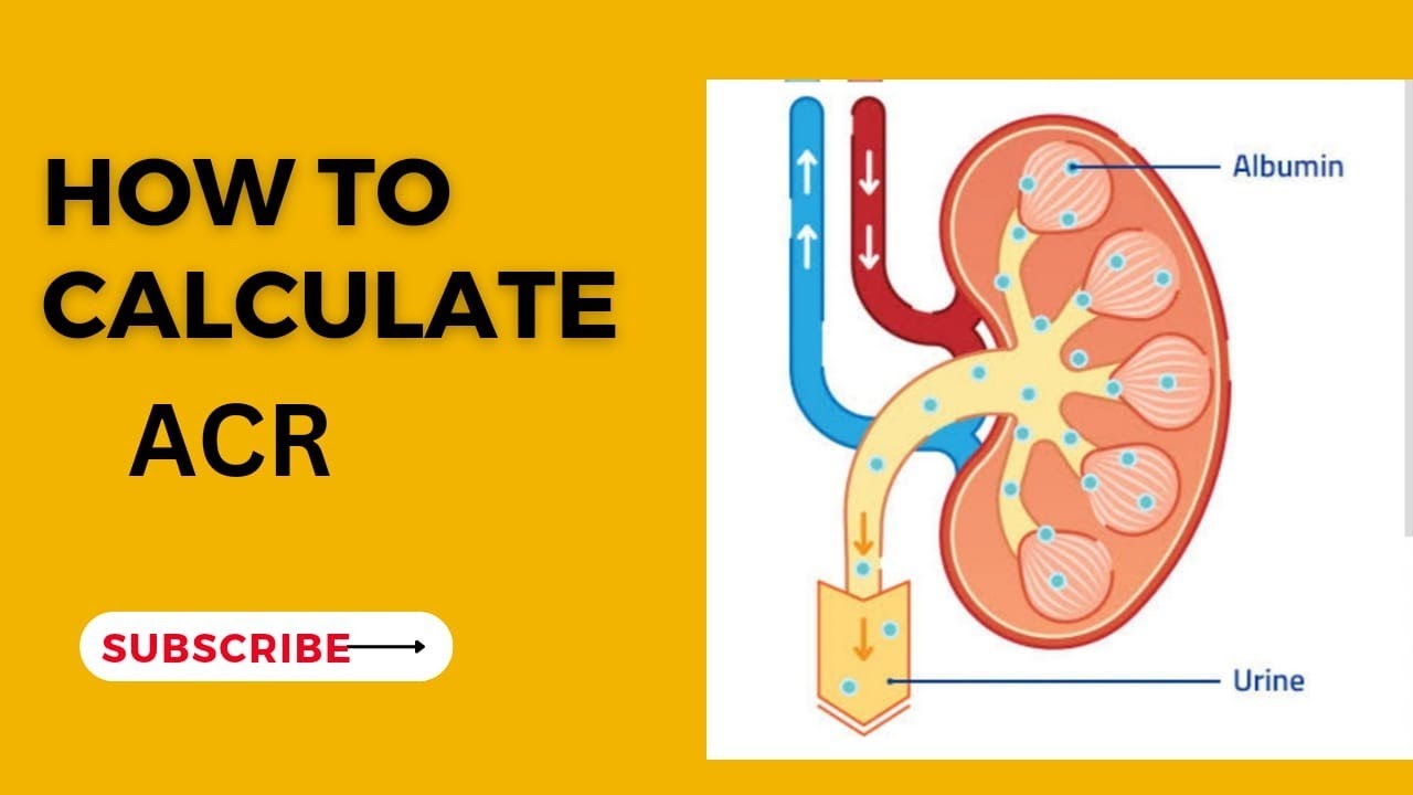 ACR Calculation | Albumin to Creatinine Ratio #diagnosis #laboratory #kidneydisease #kidneyfailure