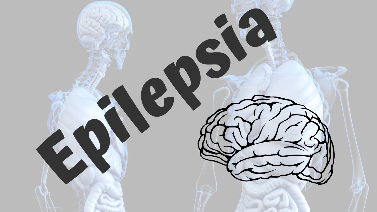Epilepsia - (conceito, diagnóstico, tipos)