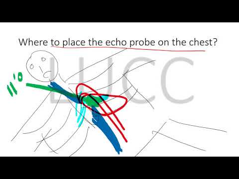 Transthoracic Echo for Beginners - the LUCC Way - Part 1 - Performing a scan