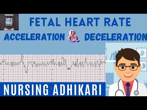DECELERATION OF FETAL HEART RATE (Early , Late and variable), Acceleration ।। Mnemonic VEAL CHOP ।।