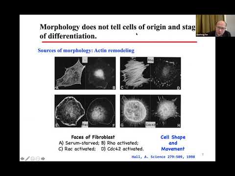 Molecular Classification-based identification of diagnostic and treatment targets in glioma