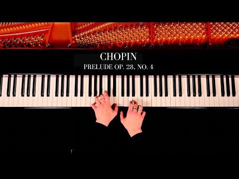 Elizaveta Frolova - Chopin Prelude in E Minor, Op. 28, No. 4