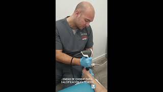 Electrolisis y ondas de choque para calcificación en tendón de aquiles