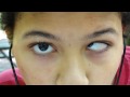 The Colby Chronicles Eye Swapping Autism