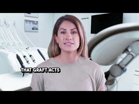 How Bone Grafts Preserve Facial Structure After Tooth Loss | Bone Graft Academy