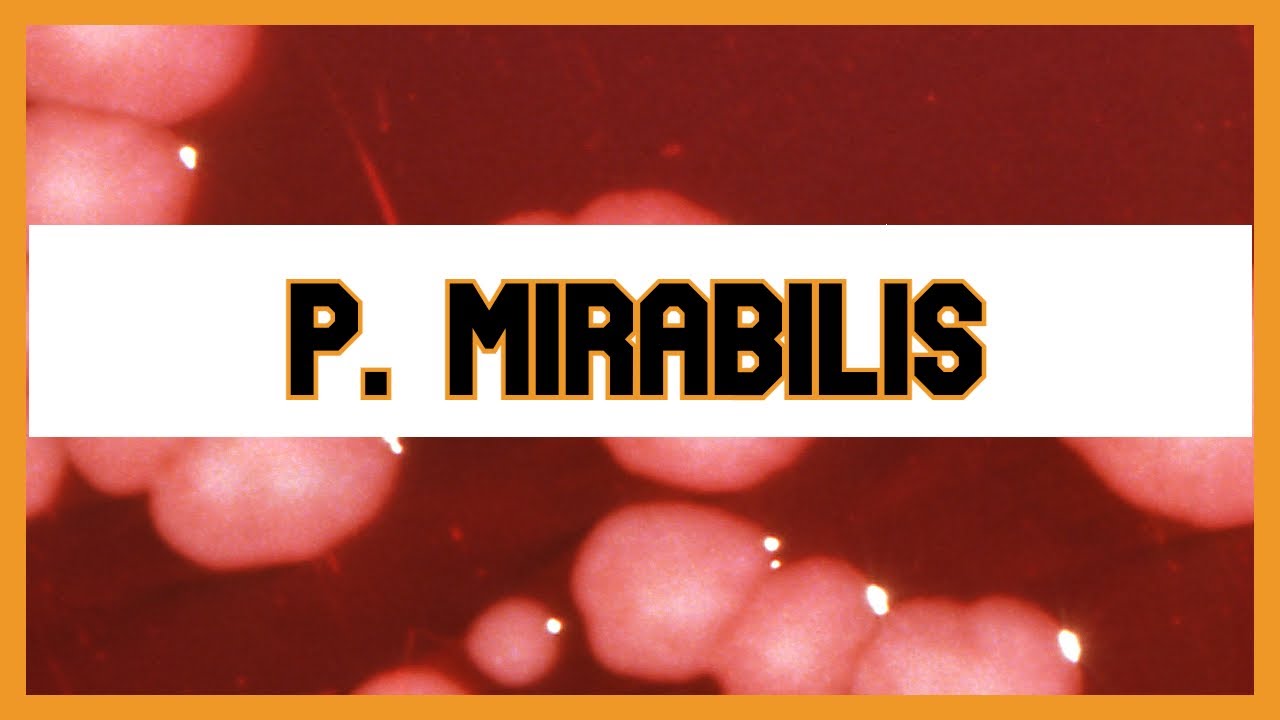 Proteus Mirabilis