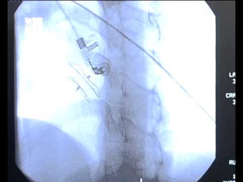 Premieră de excepţie în lumea medicală românească