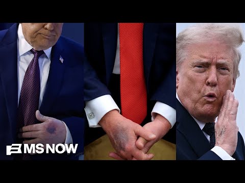 Why aren’t Democrats talking about Trump’s health?