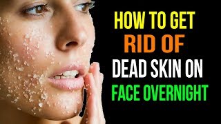 How to Get Rid of Dead skin On Face Overnight | How To Remove Dead Skin Naturally At Home