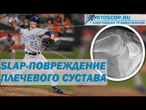Лечение суставов пальцев Артроз коленного сустава и ходьба на коленях