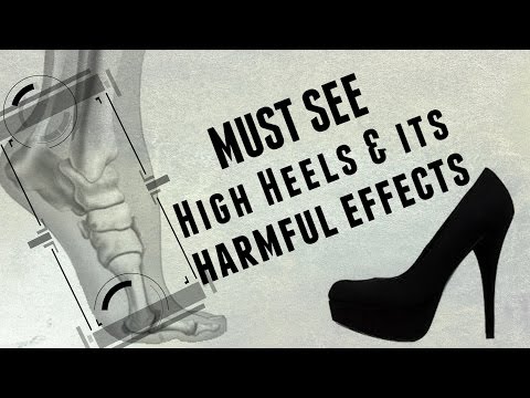 The Top 10 Best Shoes for Bunions in 2024 | Modern Foot & Ankle