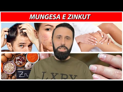 Askush nuk ju ka thënë deri më sot që mungesa e zinkut sjell gjithë këto probleme