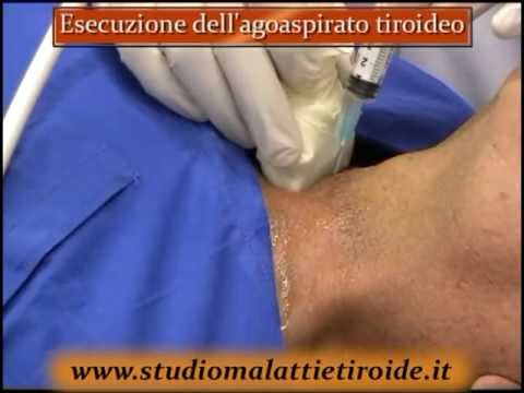 Danza terapia a caviglia doa Orecchio dolente e tira il collo