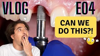 The Implant Journey Vlog - A BIG surprise | ACE diploma Journey E04