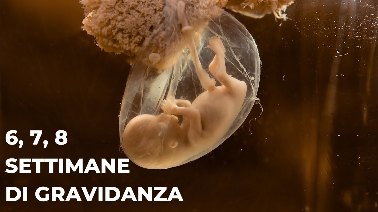 Watch Now 6, 7, 8 SETTIMANE DI GRAVIDANZA \ SECONDO MESE DI GRAVIDANZA \ CLAMOROBY 6, 7, 8 SETTIMANE DI GRAVIDANZA \ SECONDO MESE DI GRAVIDANZA \ CLAMOROBY
